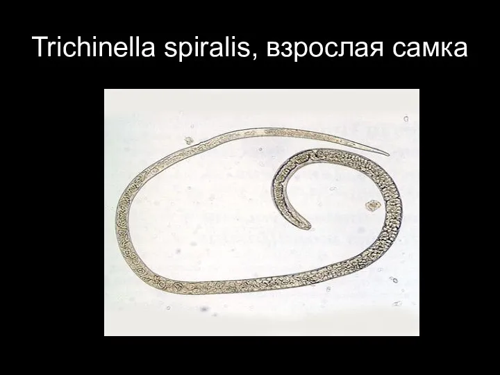 Trichinella spiralis, взрослая самка