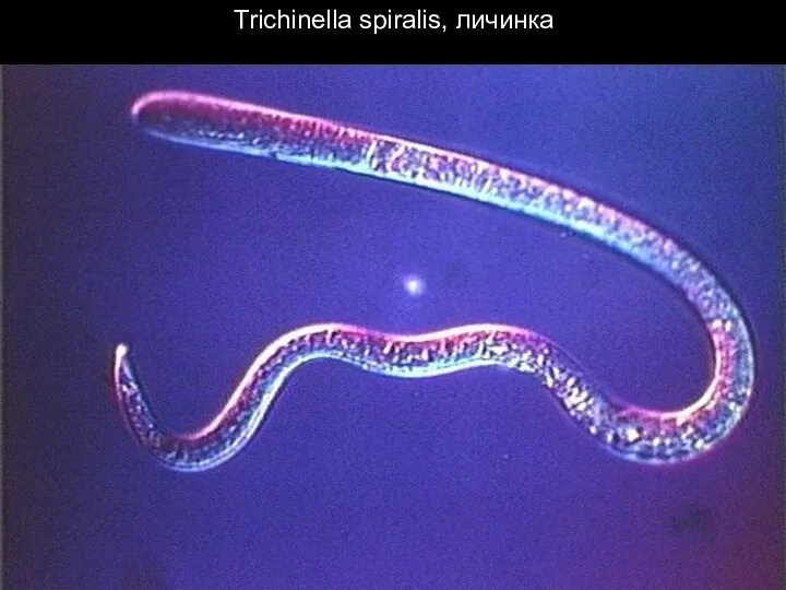 Trichinella spiralis, личинка