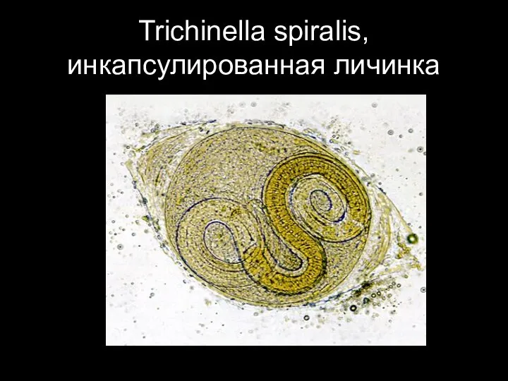 Trichinella spiralis, инкапсулированная личинка