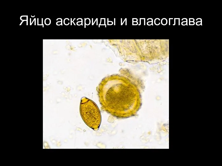 Яйцо аскариды и власоглава