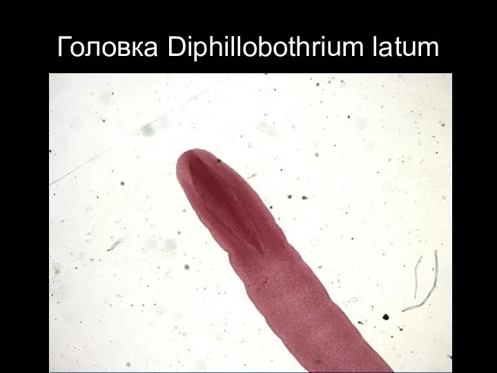 Головка Diphillobothrium latum