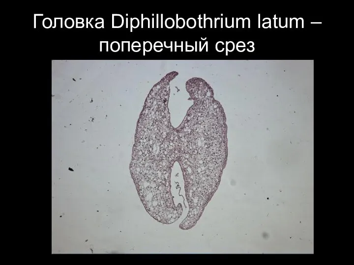 Головка Diphillobothrium latum – поперечный срез