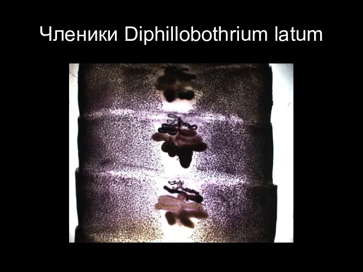 Членики Diphillobothrium latum