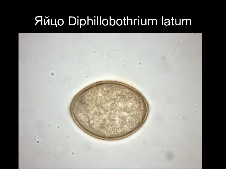 Яйцо Diphillobothrium latum