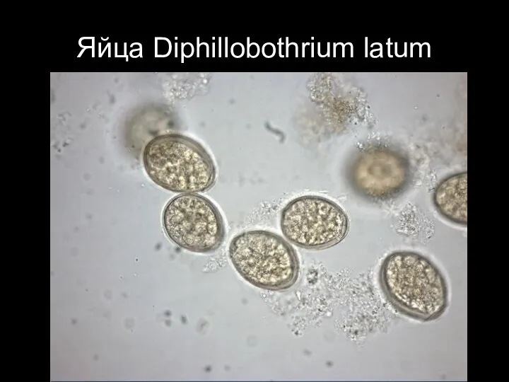 Яйца Diphillobothrium latum