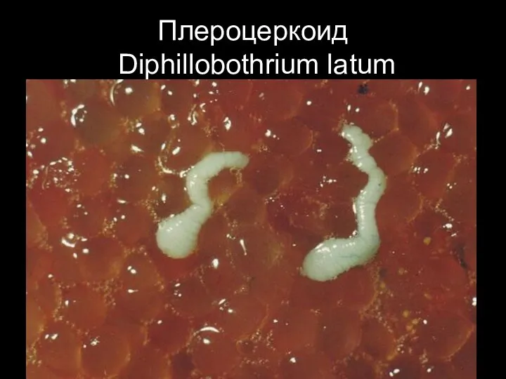 Плероцеркоид Diphillobothrium latum