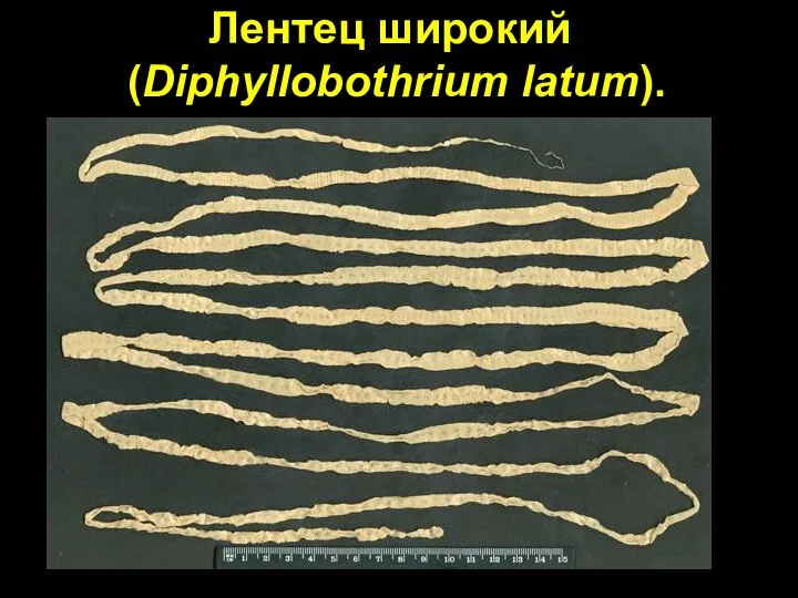 Лентец широкий (Diphyllobothrium latum).