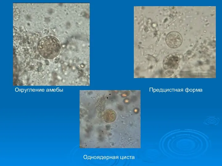 Округление амебы Предцистная форма Одноядерная циста