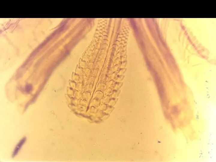 Ротовые органы иксодового клеща рода Гиалема