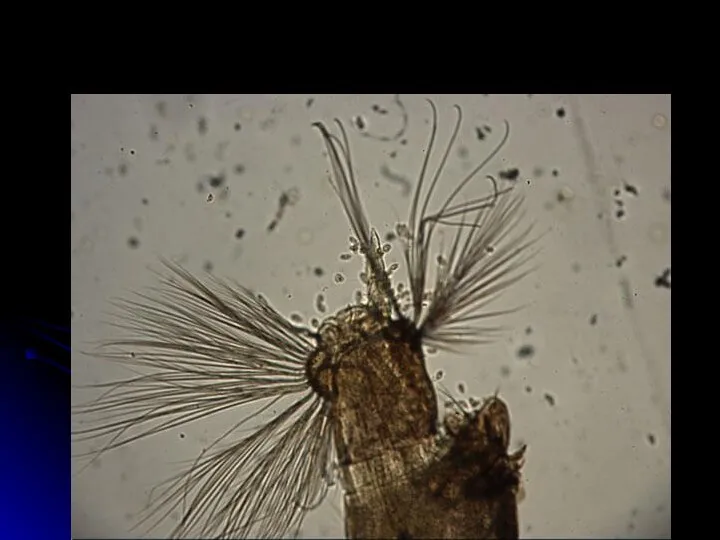 Последний членик брюшка личинки малярийного комара