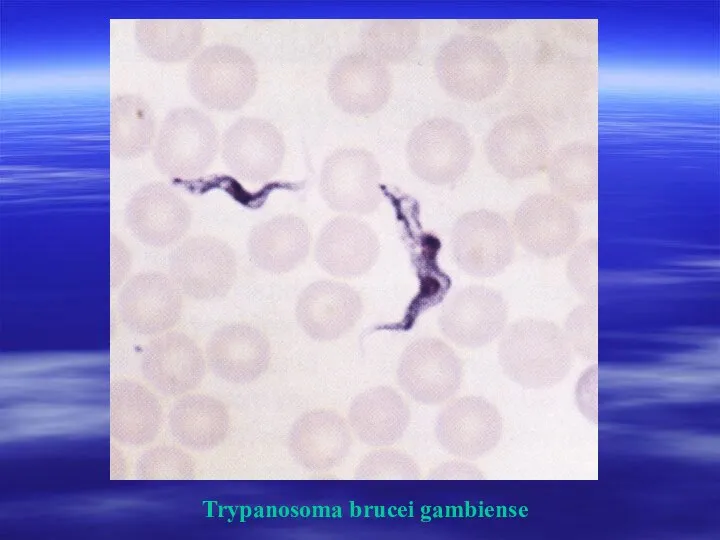 Trypanosoma brucei gambiense