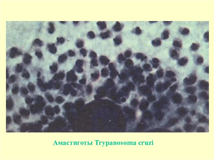 Амастиготы Trypanosoma cruzi