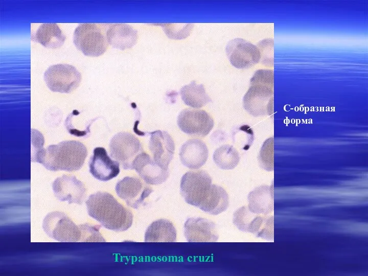 C-образная форма Trypanosoma cruzi