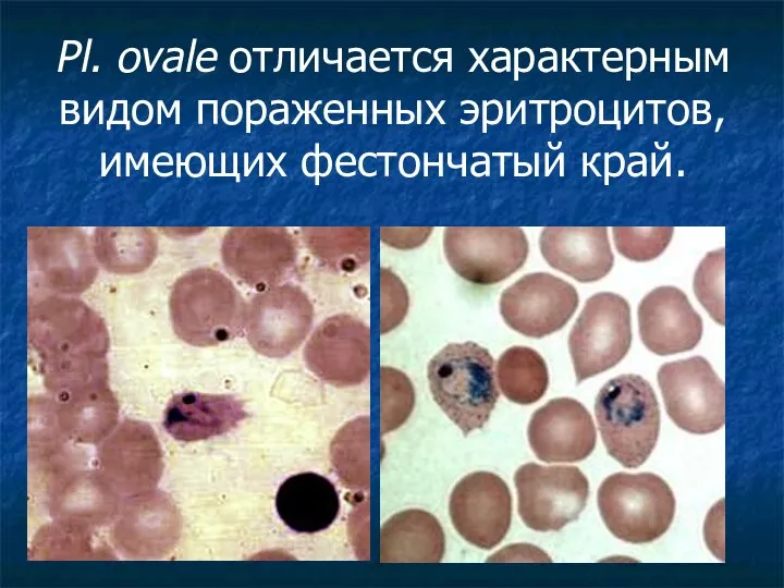 Pl. ovale отличается характерным видом пораженных эритроцитов, имеющих фестончатый край.