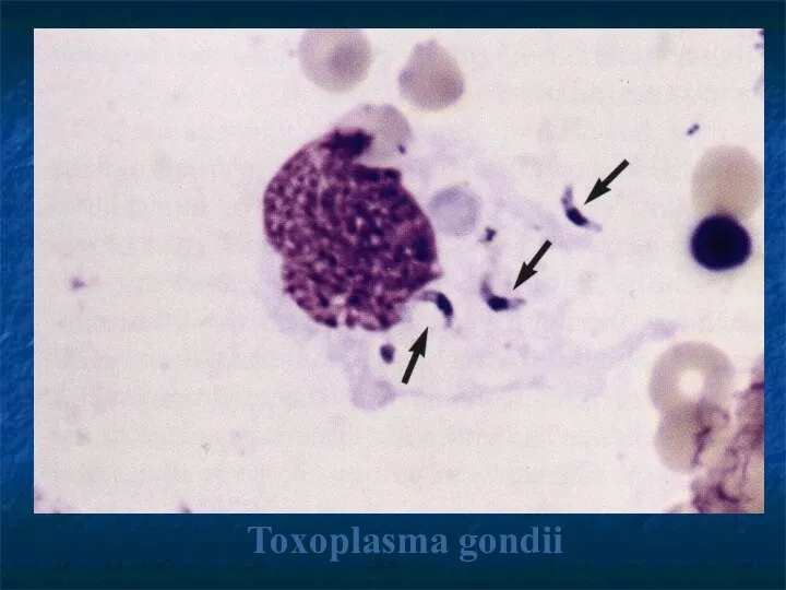 Toхoplasma gondii