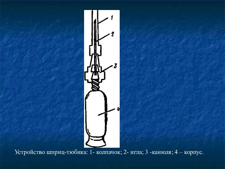 Устройство шприц-тюбика: 1- колпачок; 2- игла; 3 -канюля; 4 – корпус.