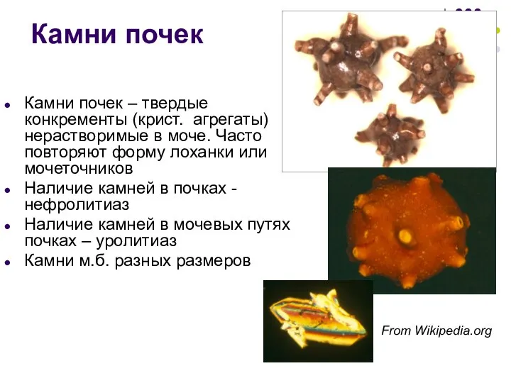 Камни почек Камни почек – твердые конкременты (крист. агрегаты) нерастворимые в