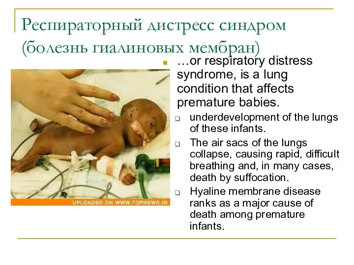 Респираторный дистресс синдром (болезнь гиалиновых мембран) …or respiratory distress syndrome, is