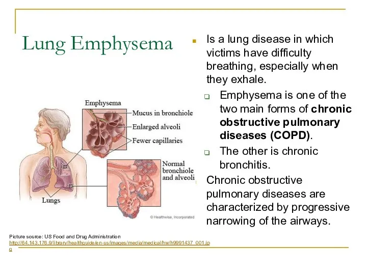 Lung Emphysema Is a lung disease in which victims have difficulty