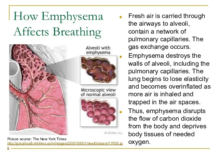 How Emphysema Affects Breathing Fresh air is carried through the airways