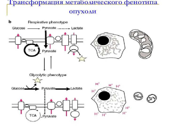 Трансформация метаболического фенотипа опухоли