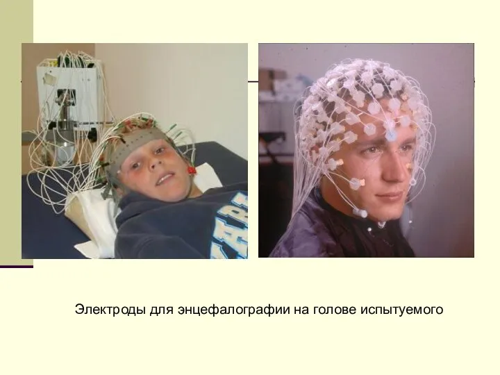 Электроды для энцефалографии на голове испытуемого