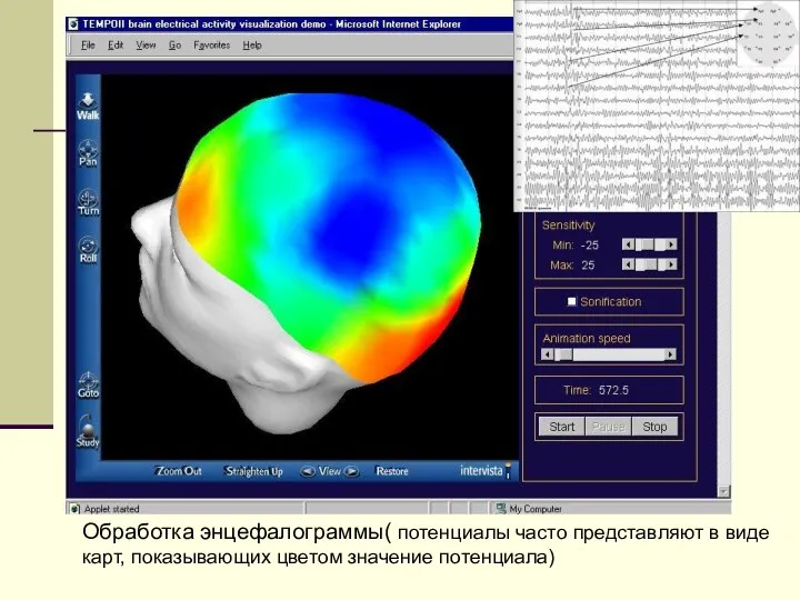 Обработка энцефалограммы( потенциалы часто представляют в виде карт, показывающих цветом значение потенциала)