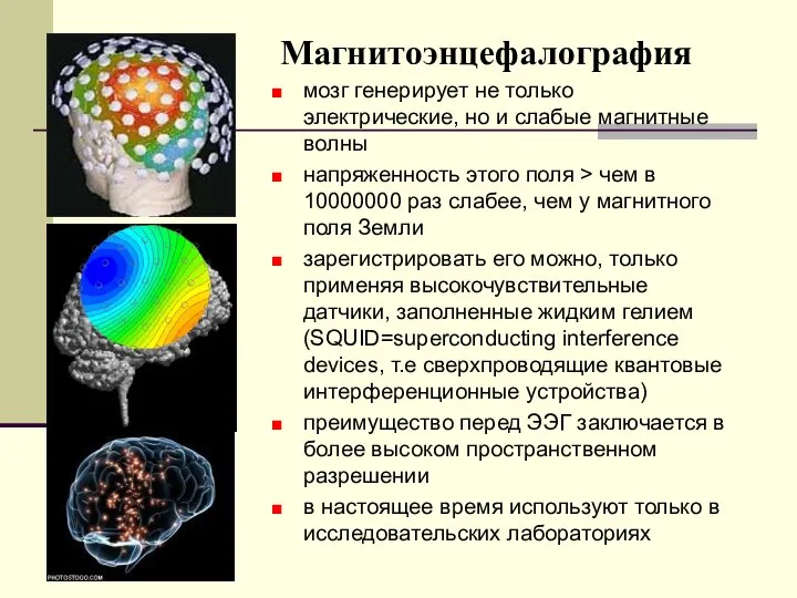 Магнитоэнцефалография мозг генерирует не только электрические, но и слабые магнитные волны