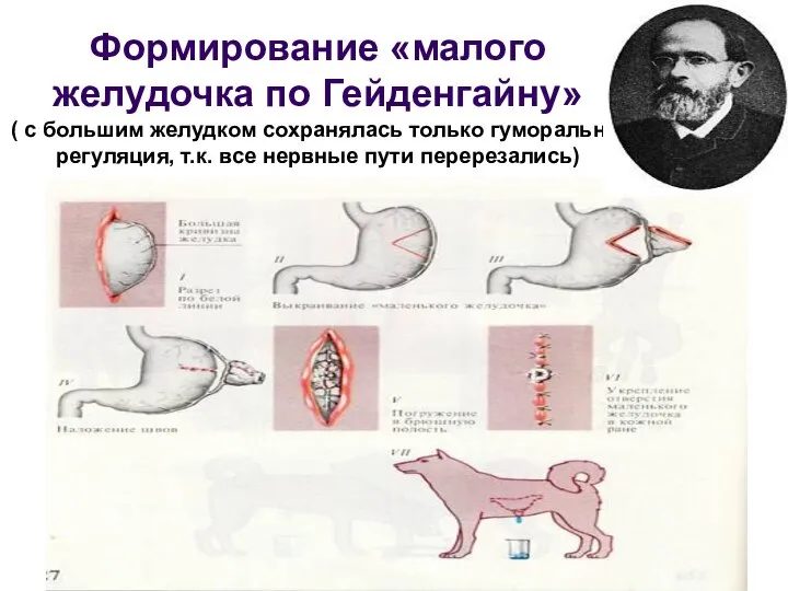 Формирование «малого желудочка по Гейденгайну» ( с большим желудком сохранялась только