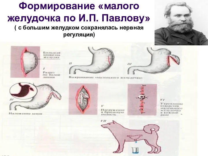 Формирование «малого желудочка по И.П. Павлову» ( с большим желудком сохранялась нервная регуляция)