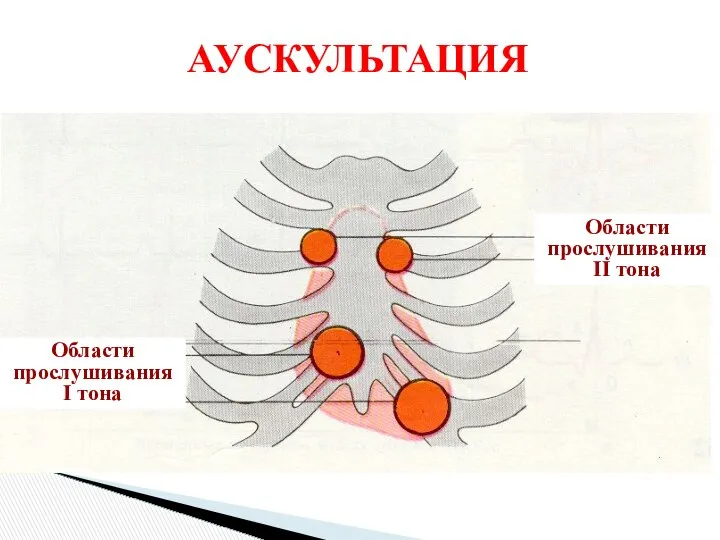 АУСКУЛЬТАЦИЯ Области прослушивания II тона Области прослушивания I тона