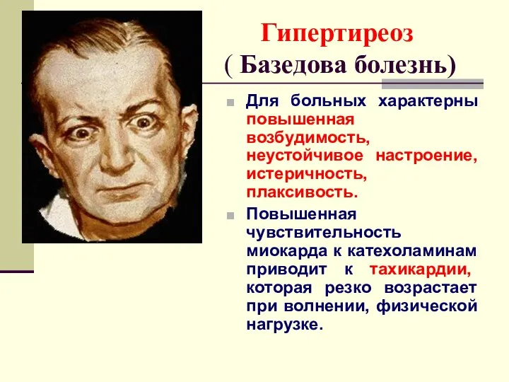 Гипертиреоз ( Базедова болезнь) Для больных характерны повышенная возбудимость, неустойчивое настроение,