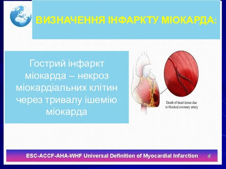 ВИЗНАЧЕННЯ ІНФАРКТУ МІОКАРДА: Гострий інфаркт міокарда – некроз міокардіальних клітин через тривалу ішемію міокарда