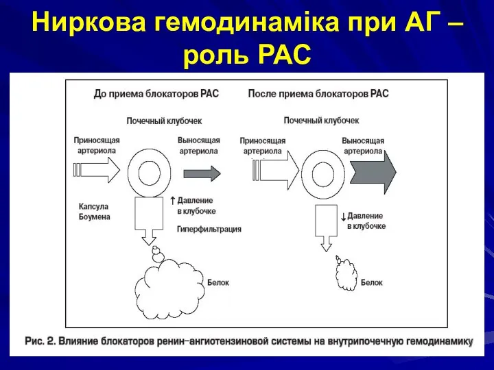 Ниркова гемодинаміка при АГ – роль РАС