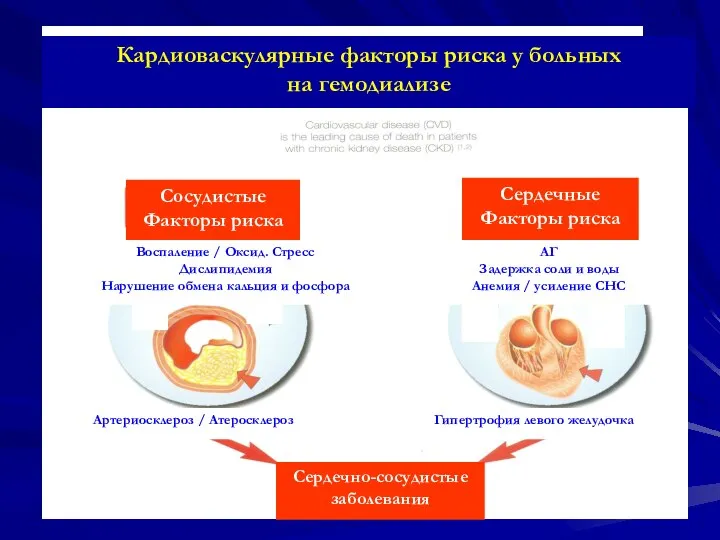 Кардиоваскулярные факторы риска у больных на гемодиализе Сосудистые Факторы риска Сердечные