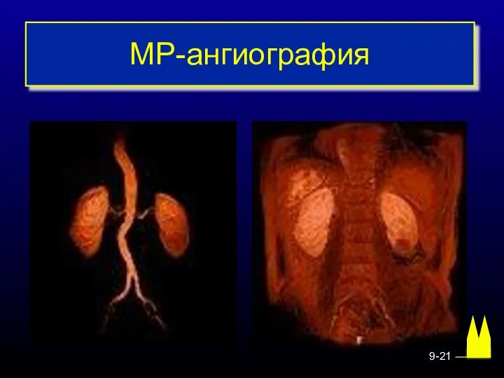 МР-ангиография 9-21