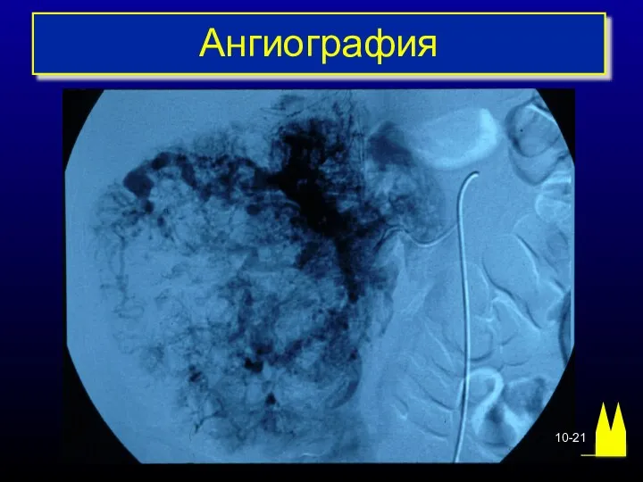 10-21 Ангиография