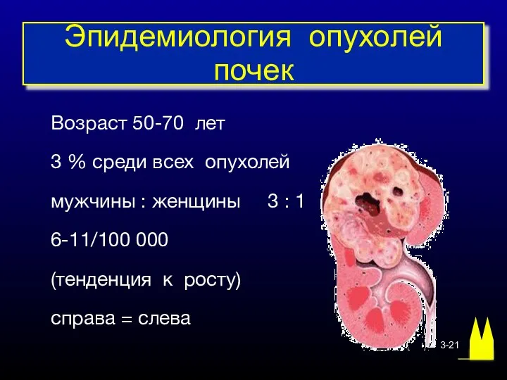 Возраст 50-70 лет 3 % среди всех опухолей мужчины : женщины