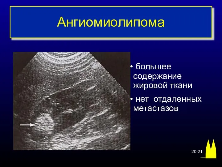 Ангиомиолипома большее содержание жировой ткани нет отдаленных метастазов 20-21