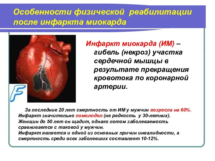 Особенности физической реабилитации после инфаркта миокарда Инфаркт миокарда (ИМ) – гибель