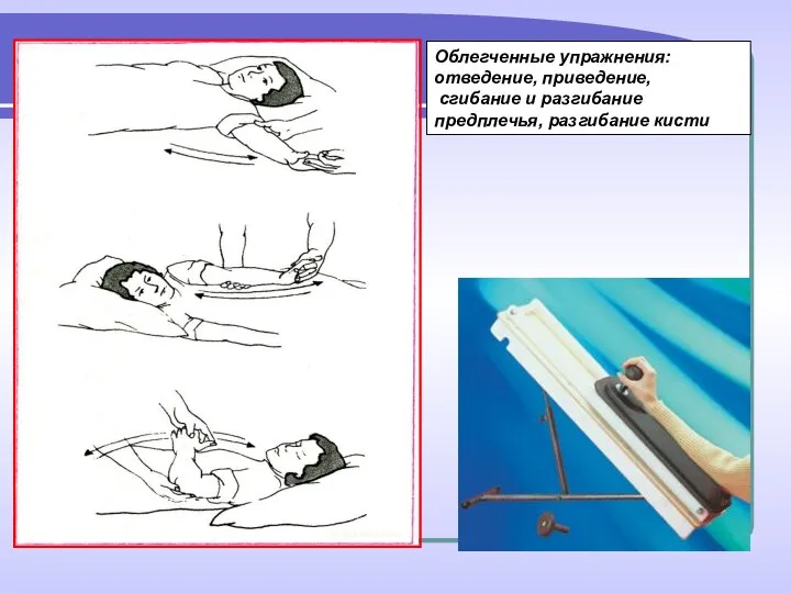 Облегченные упражнения: отведение, приведение, сгибание и разгибание предплечья, разгибание кисти