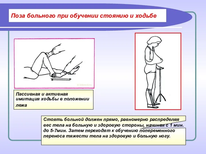 Поза больного при обучении стоянию и ходьбе Пассивная и активная имитация