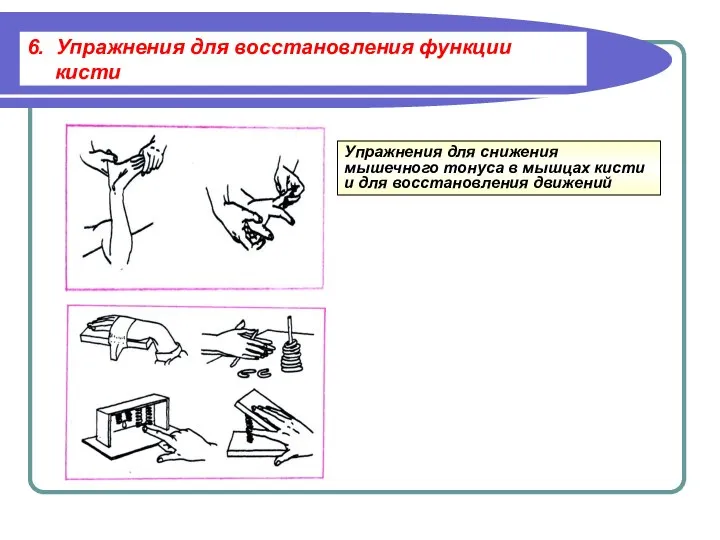 Упражнения для снижения мышечного тонуса в мышцах кисти и для восстановления