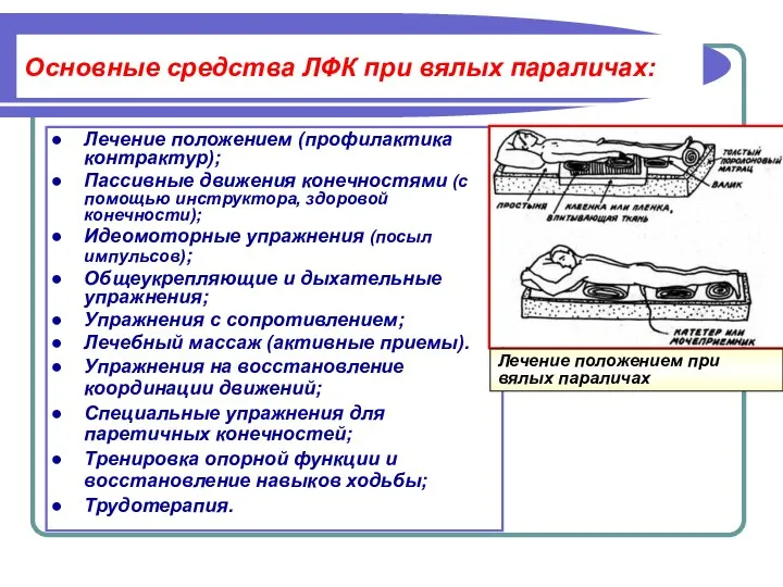 Основные средства ЛФК при вялых параличах: Лечение положением (профилактика контрактур); Пассивные