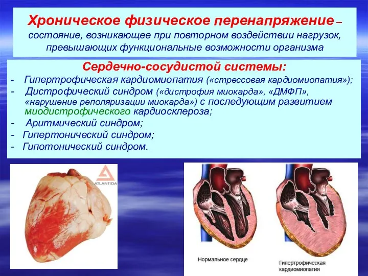 Хроническое физическое перенапряжение –состояние, возникающее при повторном воздействии нагрузок, превышающих функциональные