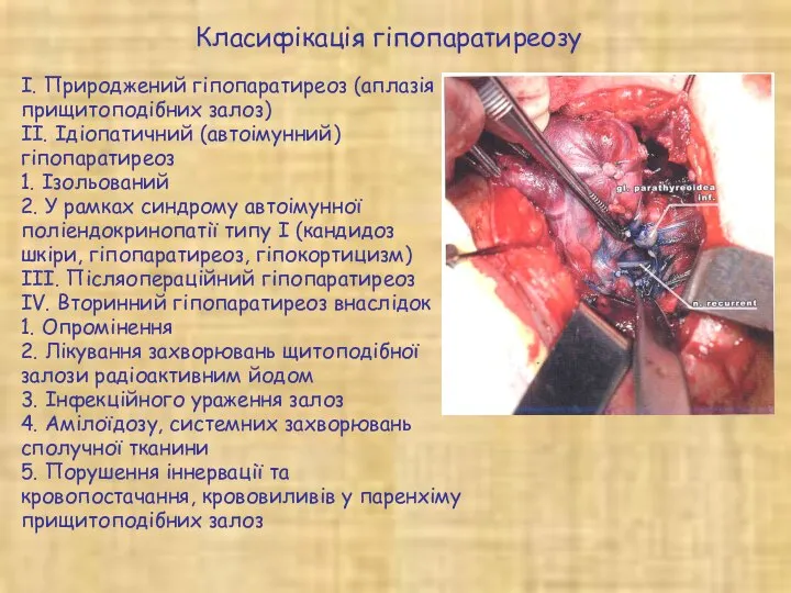 Класифікація гіпопаратиреозу І. Природжений гіпопаратиреоз (аплазія прищитоподібних залоз) II. Ідіопатичний (автоімунний)