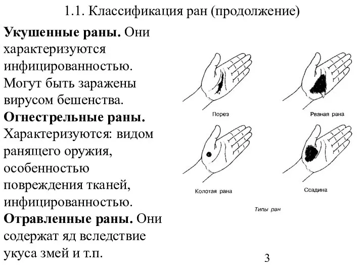 1.1. Классификация ран (продолжение) Укушенные раны. Они характеризуются инфицированностью. Могут быть