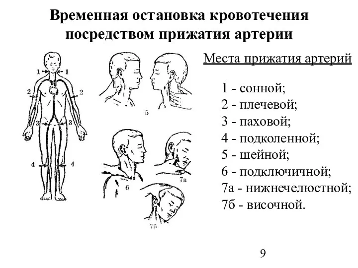 Временная остановка кровотечения посредством прижатия артерии Места прижатия артерий 1 -