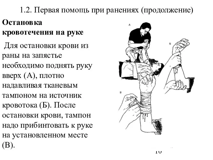 1.2. Первая помощь при ранениях (продолжение) Остановка кровотечения на руке Для