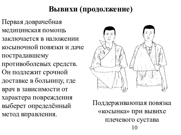 Вывихи (продолжение) Первая доврачебная медицинская помощь заключается в наложении косыночной повязки